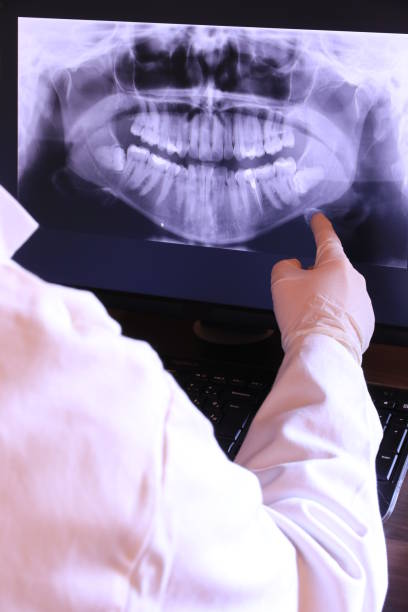 Best After-Hours Emergency Dentist in Sparta, IL